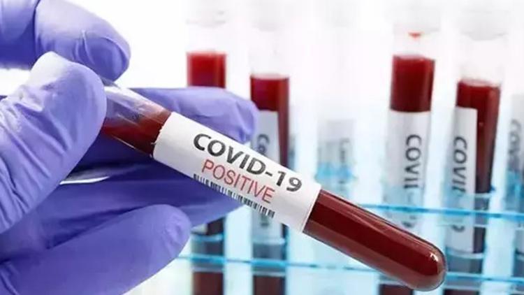 abdde-covid-19-olumleri-artti-her-hafta-300-kisi-hayatini-kaybediyor-19WVb1tK.jpg