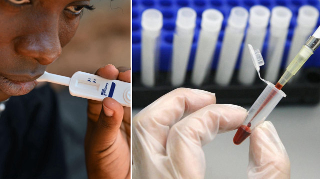 hiv-tedavisinde-tarihi-adim-virus-hucre-icinde-gorunur-h-le-getirildi-CKiEYjng.jpeg